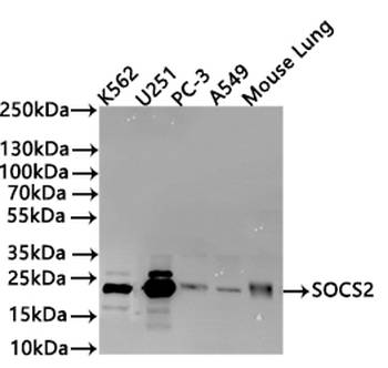 SOCS2 Antibody