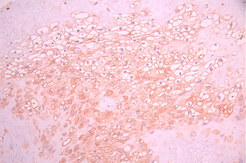 SOCS2 Antibody