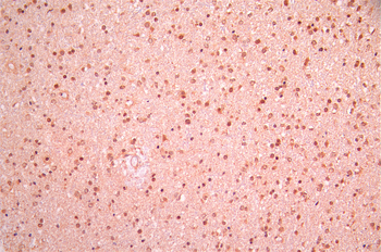 CSNK2B Antibody