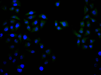 CSNK2B Antibody