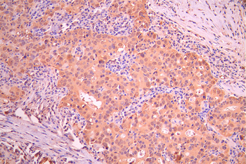 IRAK2 Antibody