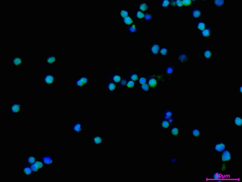 IRAK2 Antibody