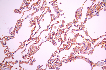 PLEC Antibody