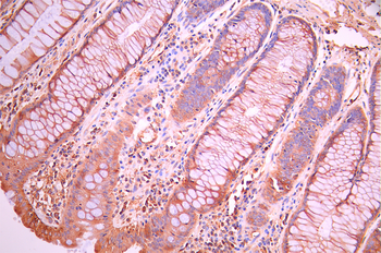 PLEC Antibody
