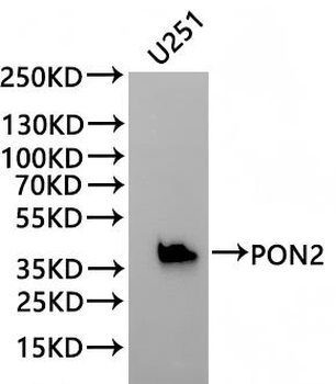PON2 Antibody