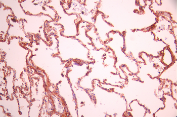 PON2 Antibody