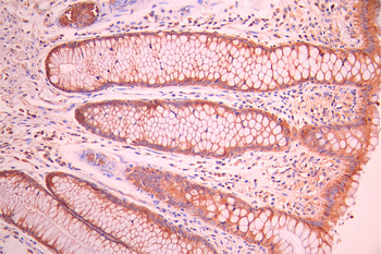 PON2 Antibody