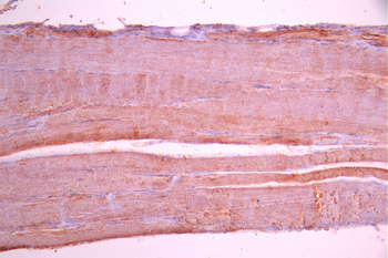 CASQ1 Antibody