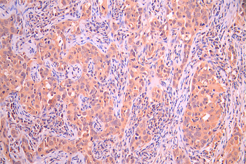 RAB4A Antibody