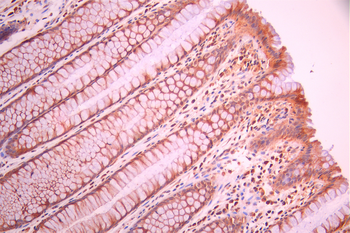 WNT2B Antibody