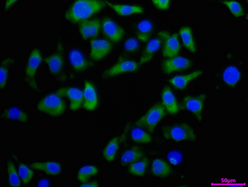 WNT2B Antibody