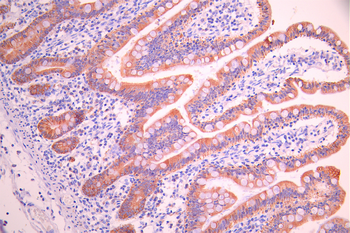 TYRP1 Antibody