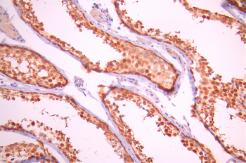 PARP2 Antibody