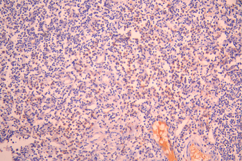 CXCL3 Antibody