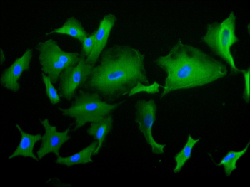 PKM Antibody