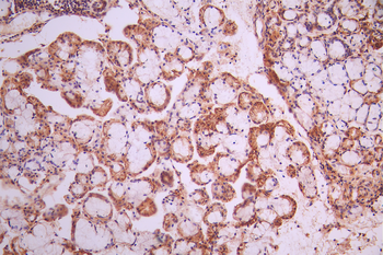 CD44 Antibody