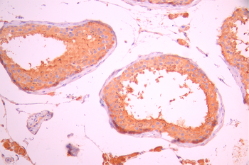 GSTM3 Antibody