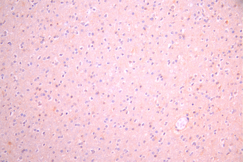 GSTM3 Antibody