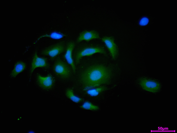 GSTM3 Antibody