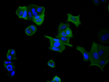GSTM3 Antibody