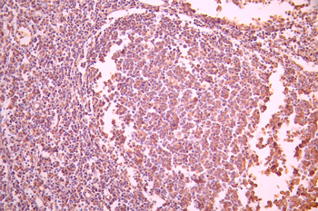ANXA1 Antibody