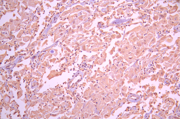 ANXA1 Antibody