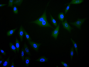 FABP4 Antibody