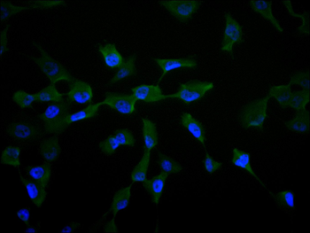 FABP4 Antibody