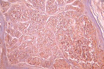 CD63 Antibody