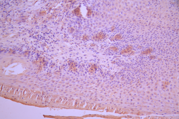 METRNL Antibody