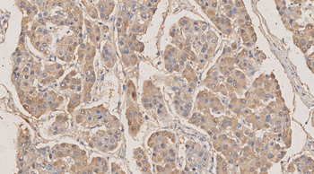 METRNL Antibody