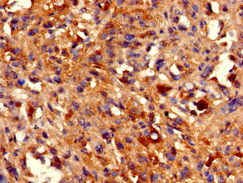 HIST1H2BB Antibody
