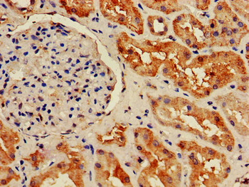 HIST1H2BB Antibody