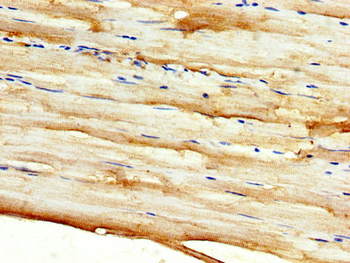 DKK2 Antibody