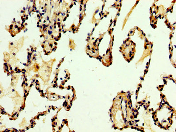 DKK2 Antibody