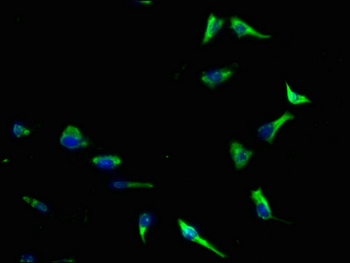 AKTIP Antibody