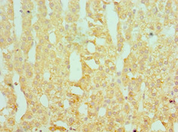 SERPINA10 Antibody