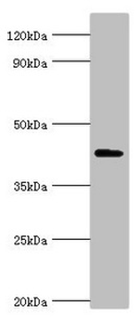 AIPL1 Antibody