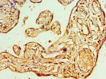 AIPL1 Antibody