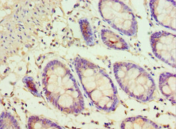 ADSS Antibody