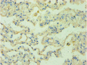 RRM2B Antibody