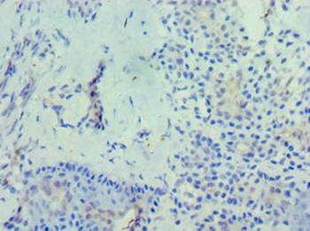 PHYH Antibody