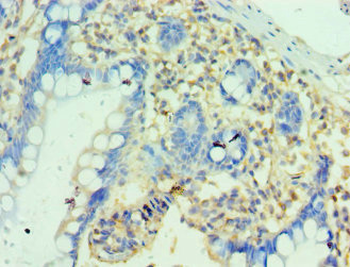 PTRH2 Antibody