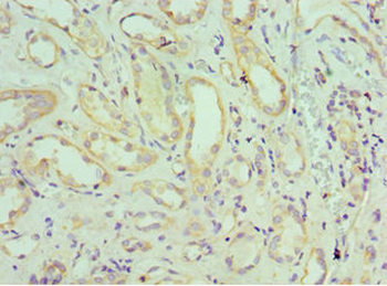 SH3GLB1 Antibody