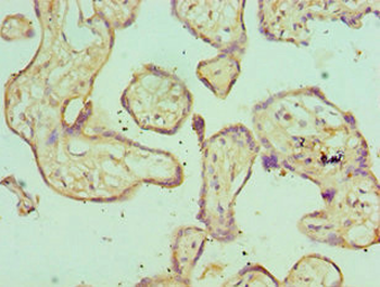 SH3GLB1 Antibody