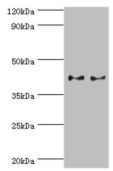 SERPINB5 Antibody