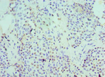 SERPINB5 Antibody