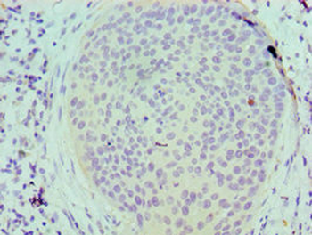 SERPINB5 Antibody