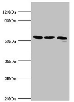 SMYD1 Antibody