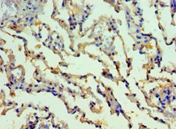 SMYD1 Antibody